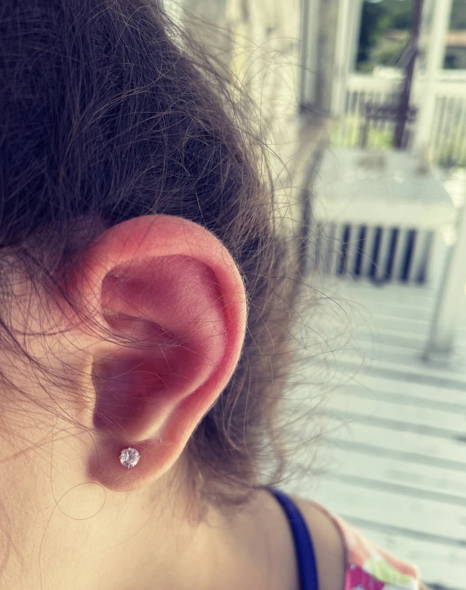 Featured image for the article Skeeter Syndrome